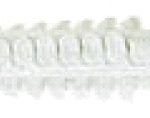 Ruusukiinnike